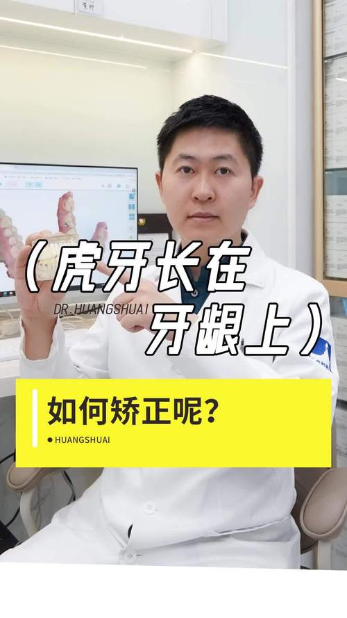 有虎牙怎么做牙齿矫正-图3