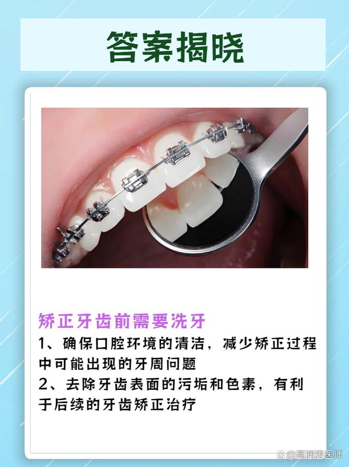 牙齿矫正完可以洗牙吗-图1