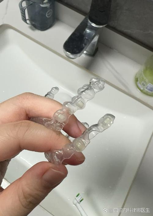 不戴牙套矫正牙齿真的可行吗？有哪些替代传统牙套的方法？-图2