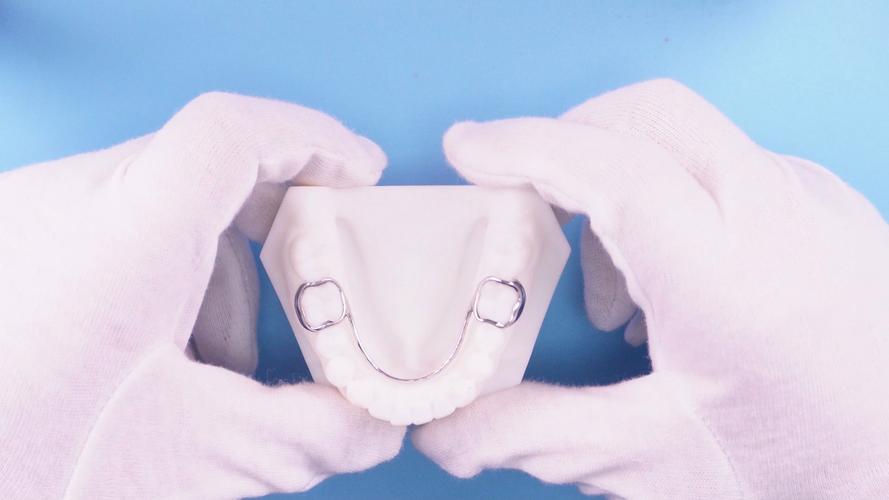 儿童矫正器哪种好？如何选到最适合孩子的？-图2