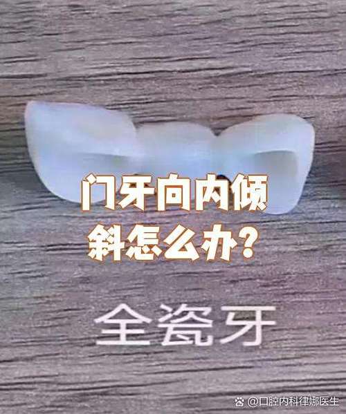 牙齿向内倾斜能矫正吗-图3