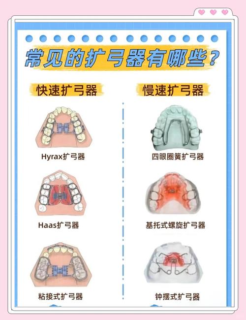 儿童牙齿矫正器有哪些-图1