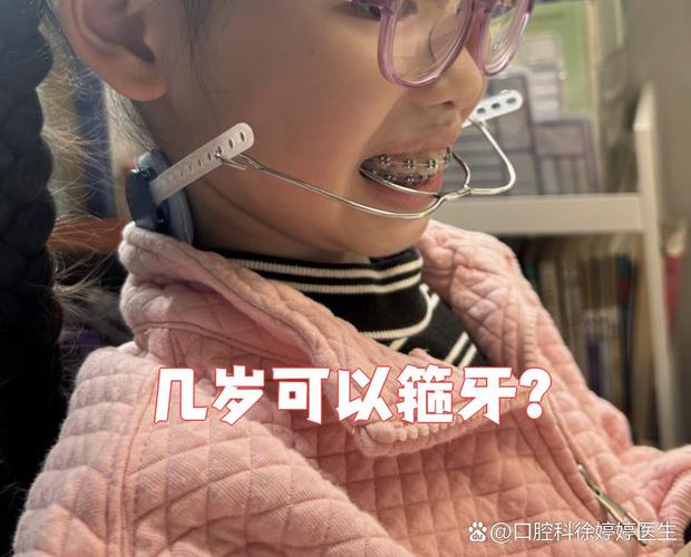 孩子多大可以牙齿矫正-图2