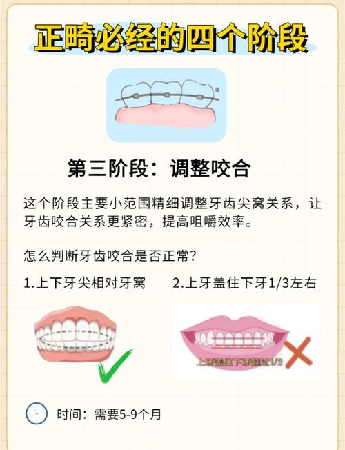 孩子多大可以牙齿矫正-图3