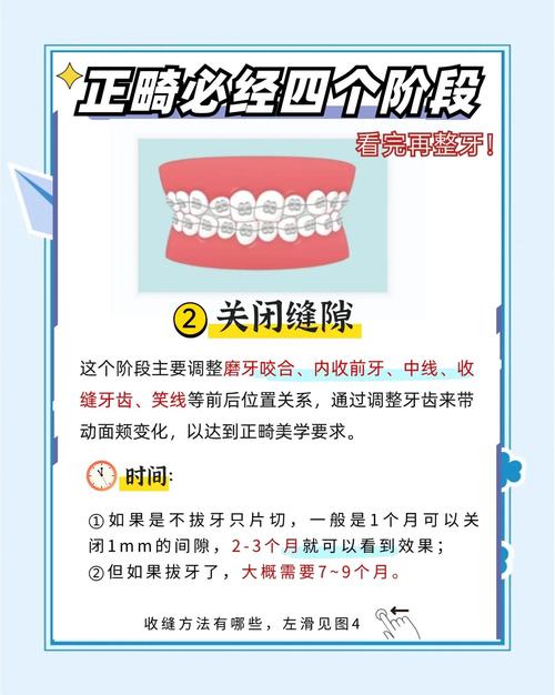 矫正牙齿一般要带多久-图3