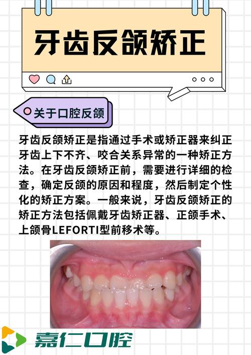 牙齿矫正手术风险大吗？想了解清楚-图2