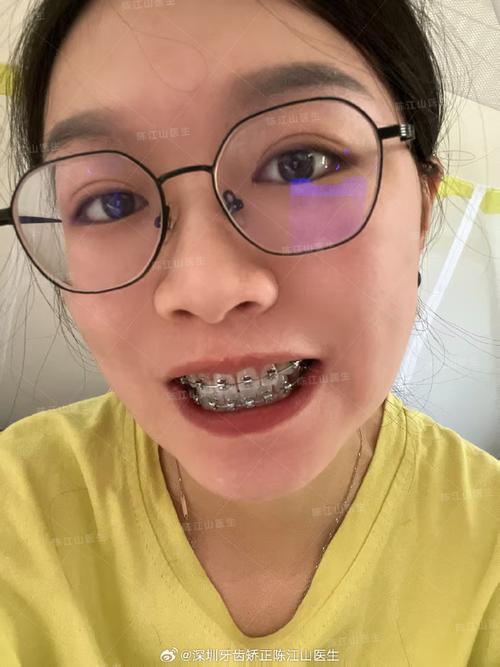深圳牙齿矫正哪家好？如何选靠谱的矫正机构和医生？-图2