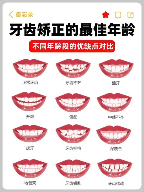 矫正牙齿多少岁前做效果最好？有最佳年龄限制吗？-图3