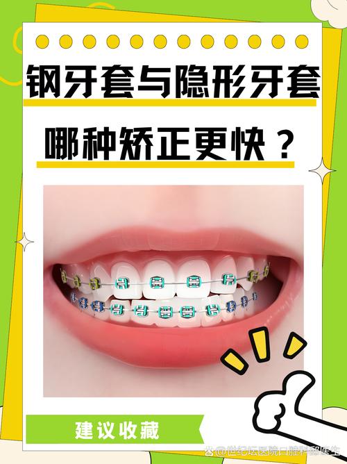 矫正牙齿去哪里比较好-图3