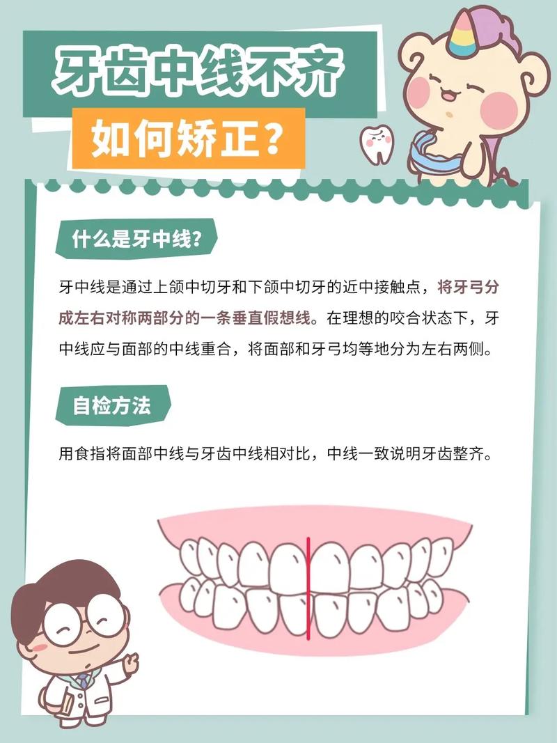 牙齿矫正牙箍总掉原因-图2