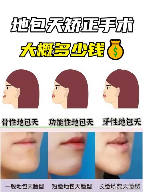 地包牙矫正费用大概多少？求具体范围参考～-图2