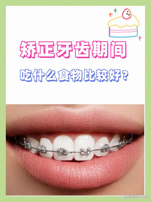矫正牙齿期间,哪些食物能吃?哪些不能吃?饮食选择有讲究?-图3 矫正牙齿期间,哪些食物能吃?哪些不能吃?饮食选择有讲究?-图3