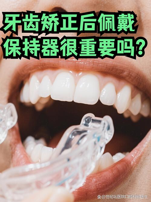 矫正牙齿后，保持器要戴多久？-图2