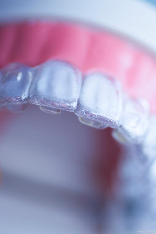 牙齿矫正后保持器图片能看出啥效果？-图3