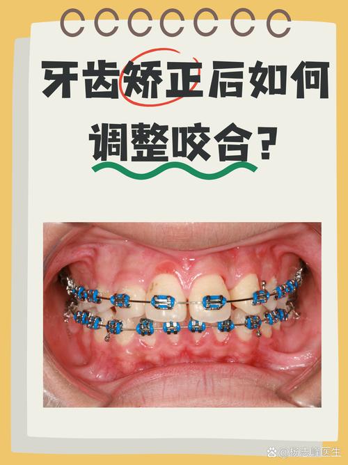 门牙缺失，矫正牙齿还有办法吗？-图1