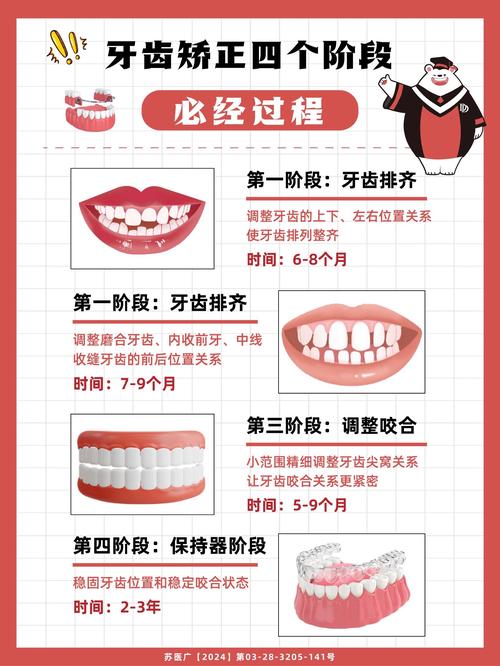 牙齿矫正咬合调整时间一般需要多久？-图1