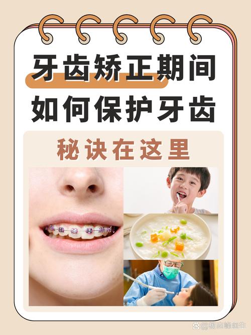 牙齿矫正咬合调整时间一般需要多久？-图2