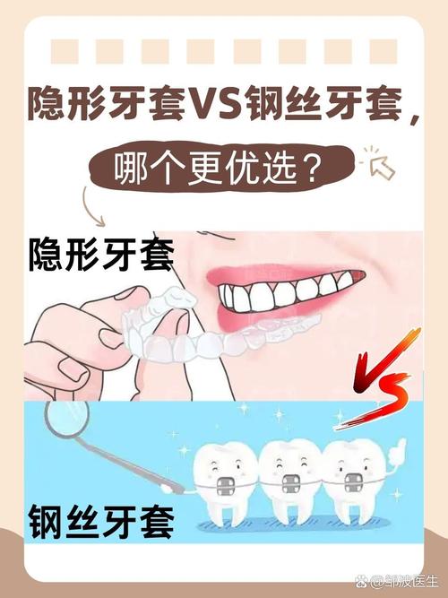 矫正牙齿换钢丝是否需要额外收费？-图3