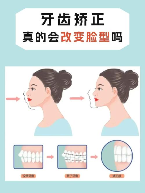 矫正牙齿会影响鼻子的形状或外观吗？-图1