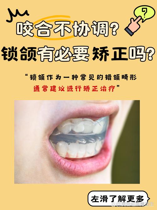 牙齿咬合不齐，矫正该做吗？-图1