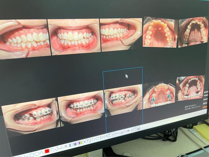 深圳康圆牙齿矫正医院-图1