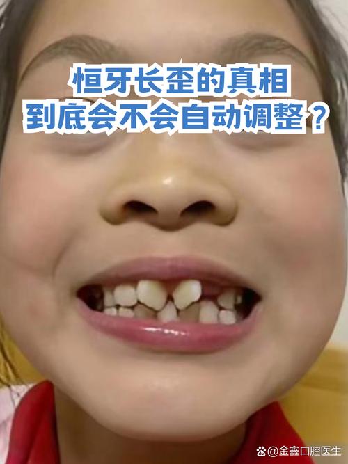 小孩牙齿长歪怎么矫正？不同年龄段矫正方法有哪些？-图1