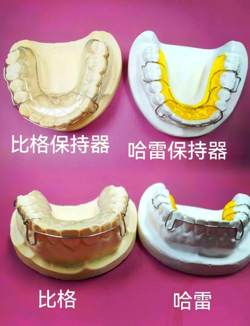 牙齿矫正里的铁丝到底是什么材质?-图2 牙齿矫正里的铁丝到底是什么材质?-图2