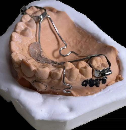 牙齿矫正里的铁丝到底是什么材质？-图3