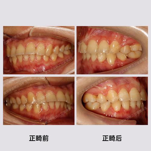 同济医院有牙齿矫正吗-图2