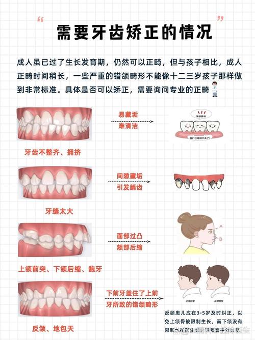牙齿矫正对关节的影响-图2