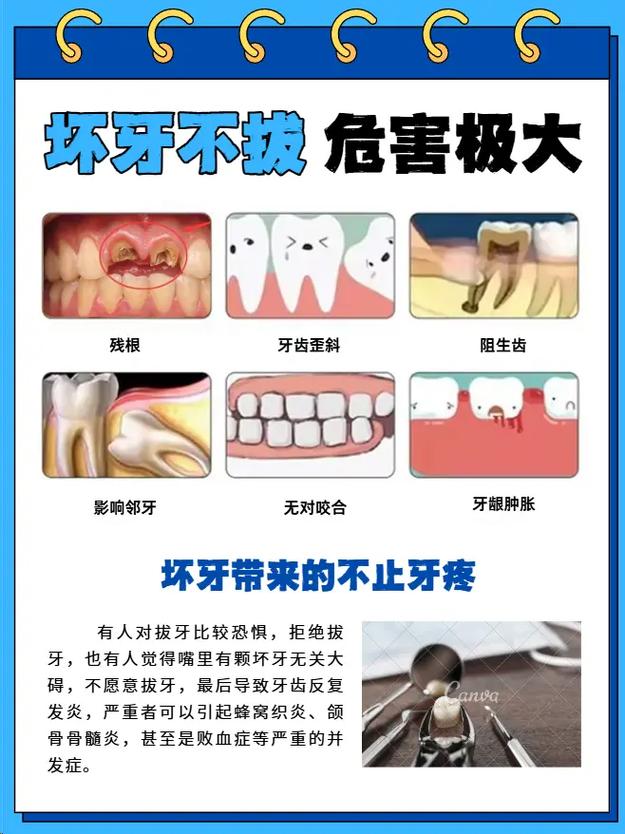 牙齿矫正对关节的影响-图3