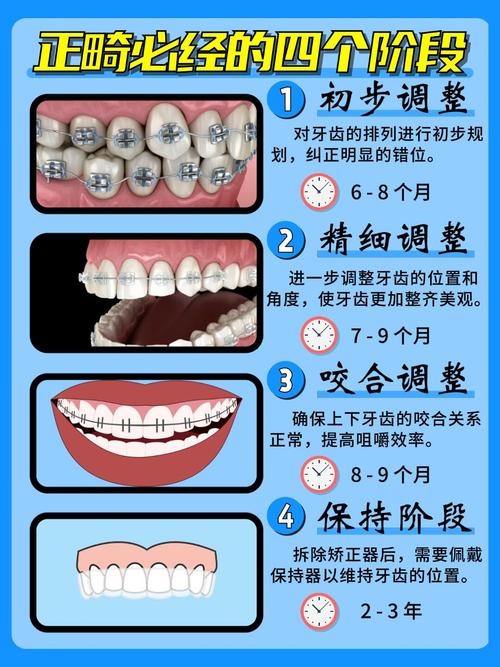 牙齿矫正后多久能看到明显变化?-图2 牙齿矫正后多久能看到明显变化?-图2