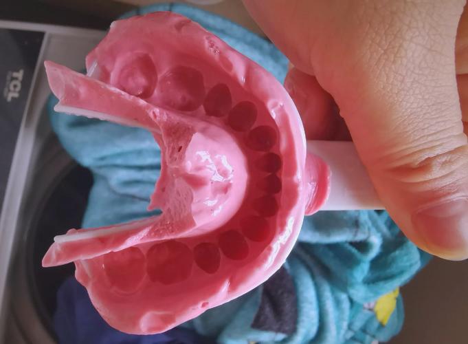 隐形矫正取模视频，取模过程详细步骤有哪些需要注意的？-图1