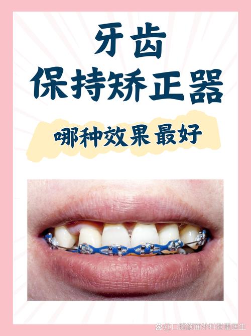 矫正牙齿哪里便宜又好？求性价比高又靠谱的推荐！-图2