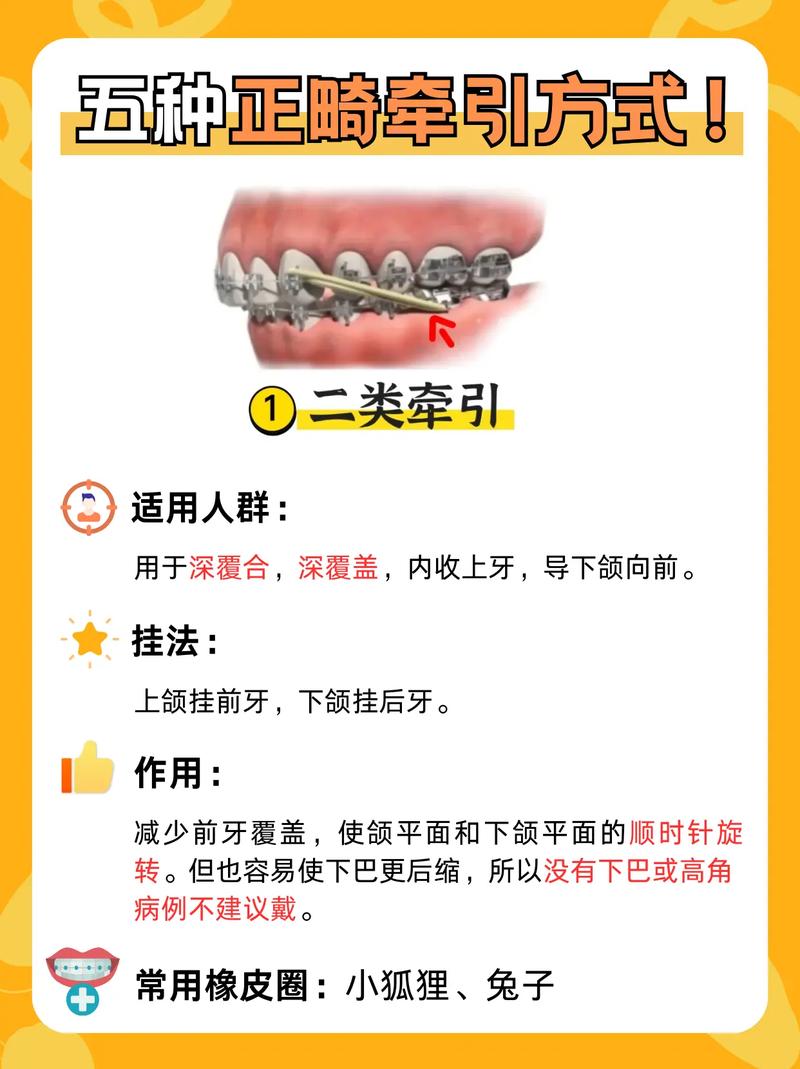 矫正牙齿橡皮链的作用究竟是什么？-图1