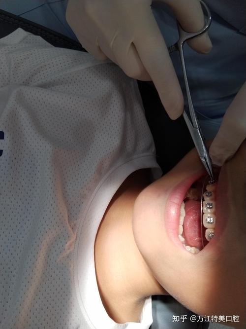 东莞牙齿矫正怎么选最正规?靠谱机构有哪些判断方法?-图2 东莞牙齿矫正怎么选最正规?靠谱机构有哪些判断方法?-图2