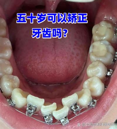牙齿磨损严重，还能矫正吗？-图1