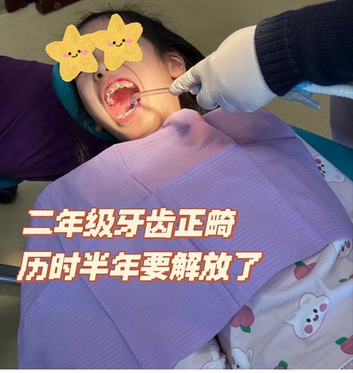 小孩牙齿矫正最佳年龄是多大?-图2 小孩牙齿矫正最佳年龄是多大?-图2