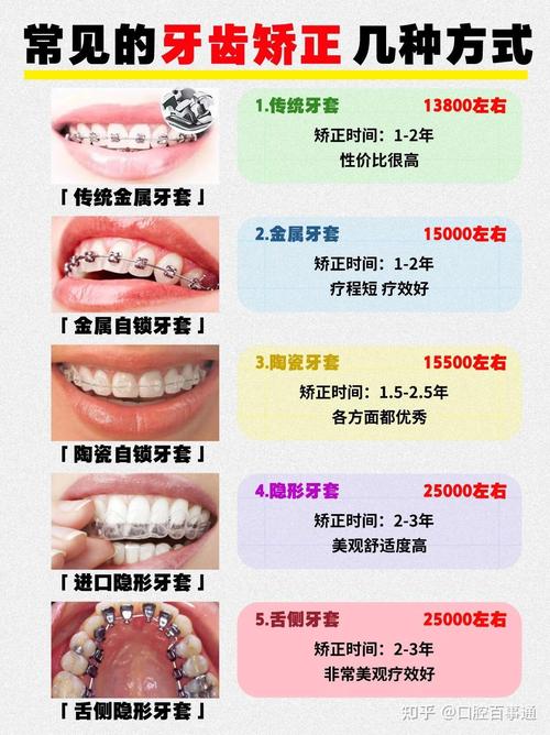 矫正牙齿选医院哪家好？看资质、案例、设备这几点就够了-图2