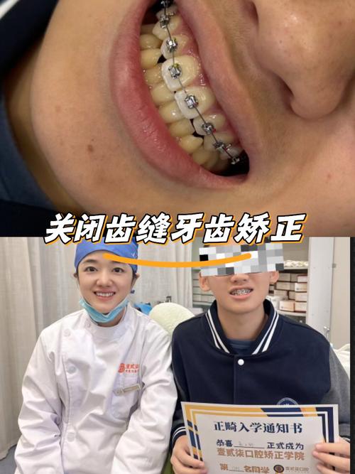 青岛口腔医院矫正牙齿效果如何？价格贵不贵？靠谱吗？-图3