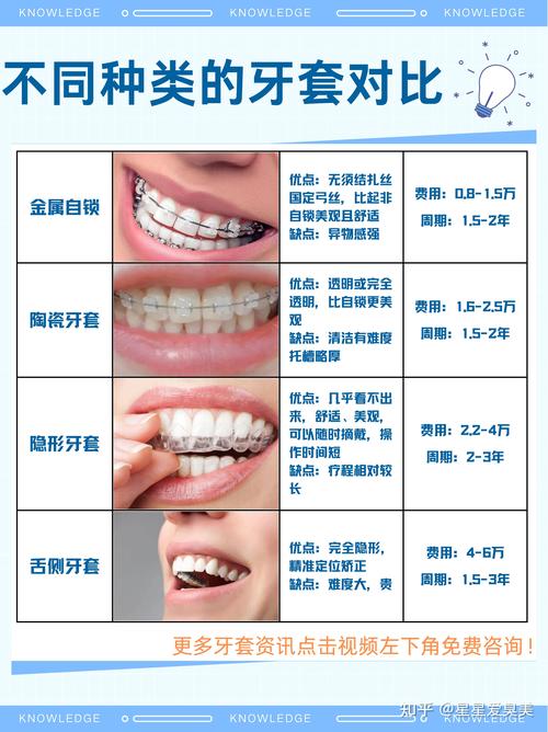 矫正牙齿带多久有效果-图1