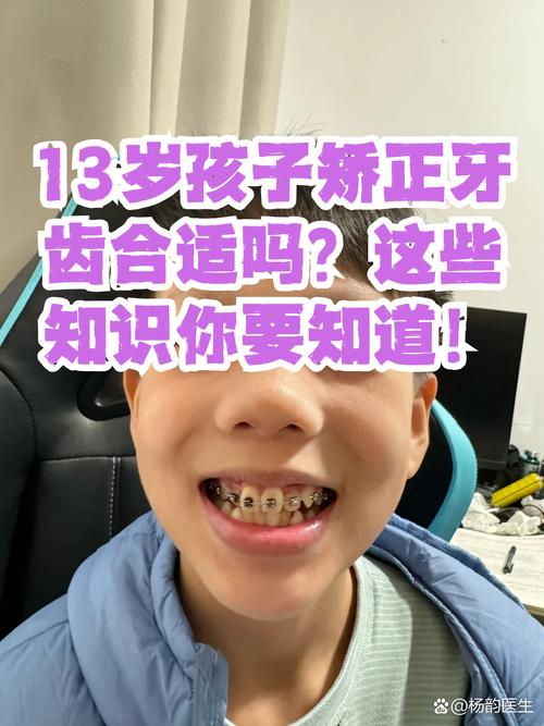 儿童牙齿矫正的最佳时期究竟在几岁？-图1