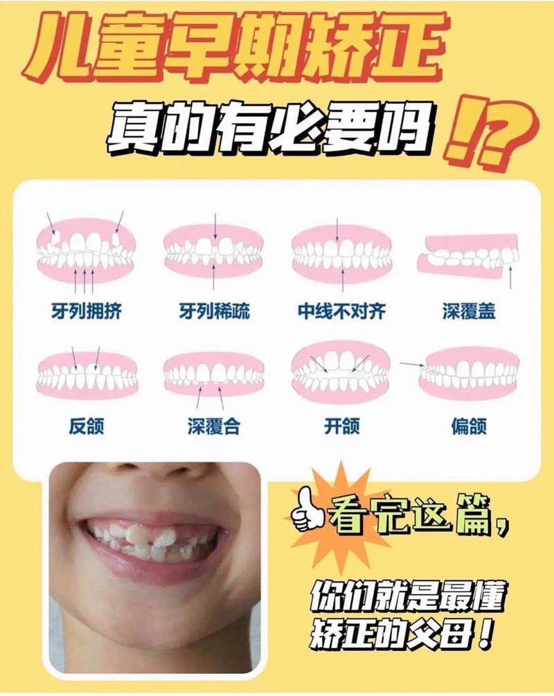 矫正牙齿必须磨牙吗？-图1