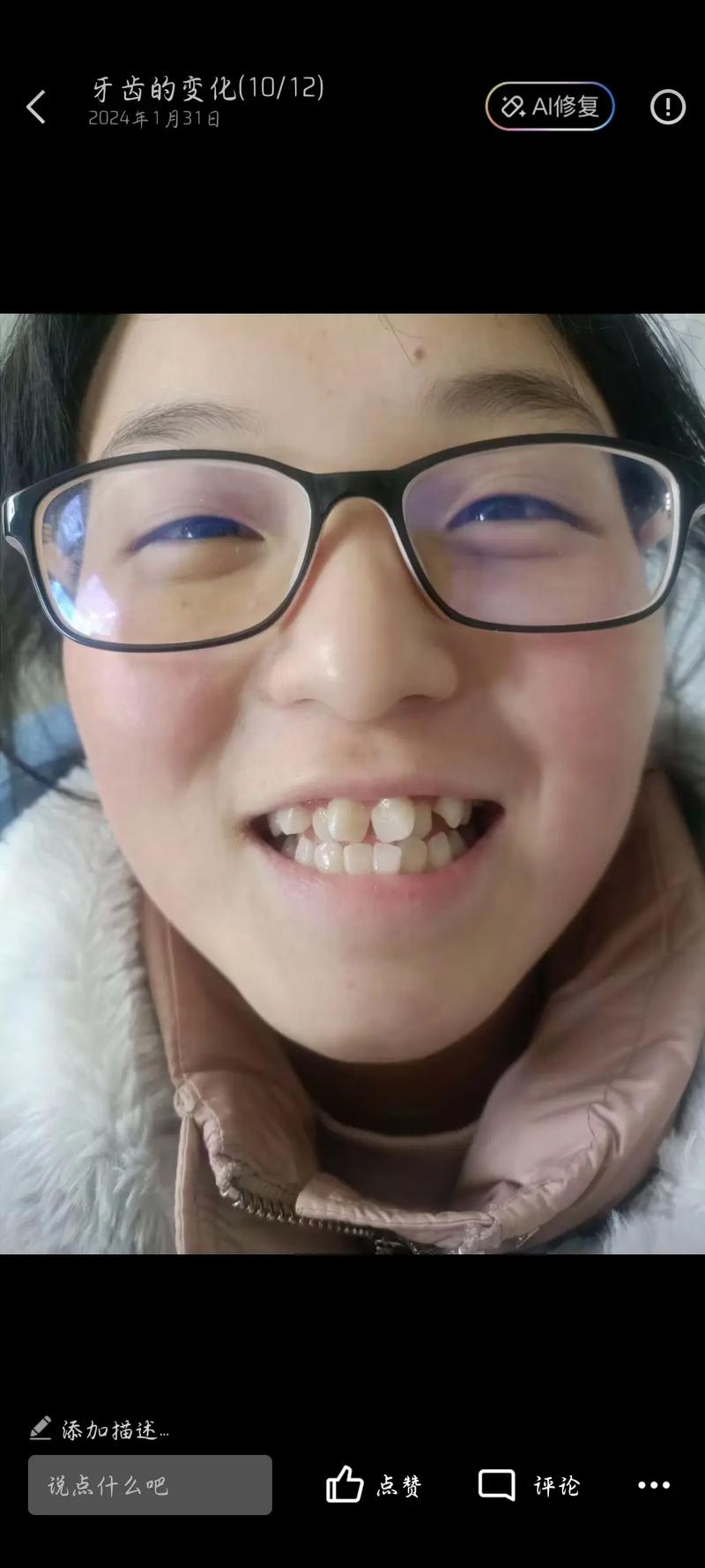 牙齿矫正后牙酸，是正常现象吗？该如何缓解？-图3