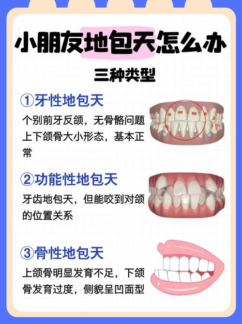 地包天矫正示意图有哪些关键步骤?-图3 地包天矫正示意图有哪些关键步骤?-图3
