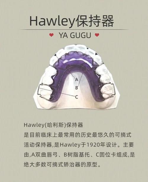 矫正牙齿后，保持器有哪些常见类型？-图1