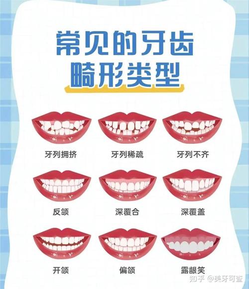 孕后矫正牙齿要等多久?最佳安全时间点是什么时候?-图2 孕后矫正牙齿要等多久?最佳安全时间点是什么时候?-图2