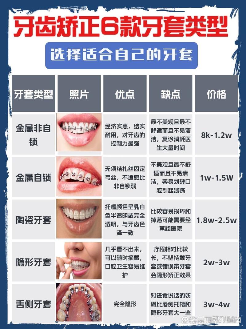 牙齿矫正牙套怎么选？不同类型哪种更适合你的情况？-图3