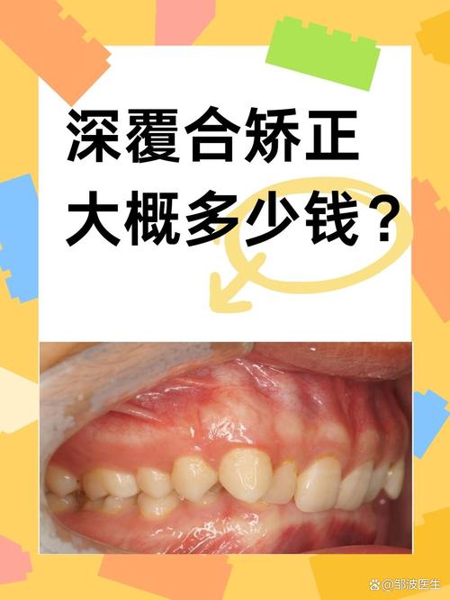 深圳哪里的矫正牙齿好-图1