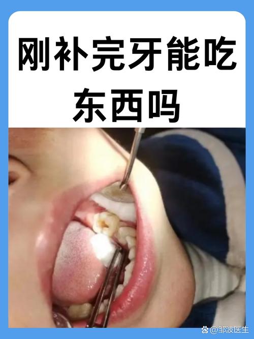 补过的牙齿还能矫正吗？-图1